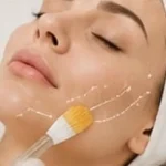 04 peeling